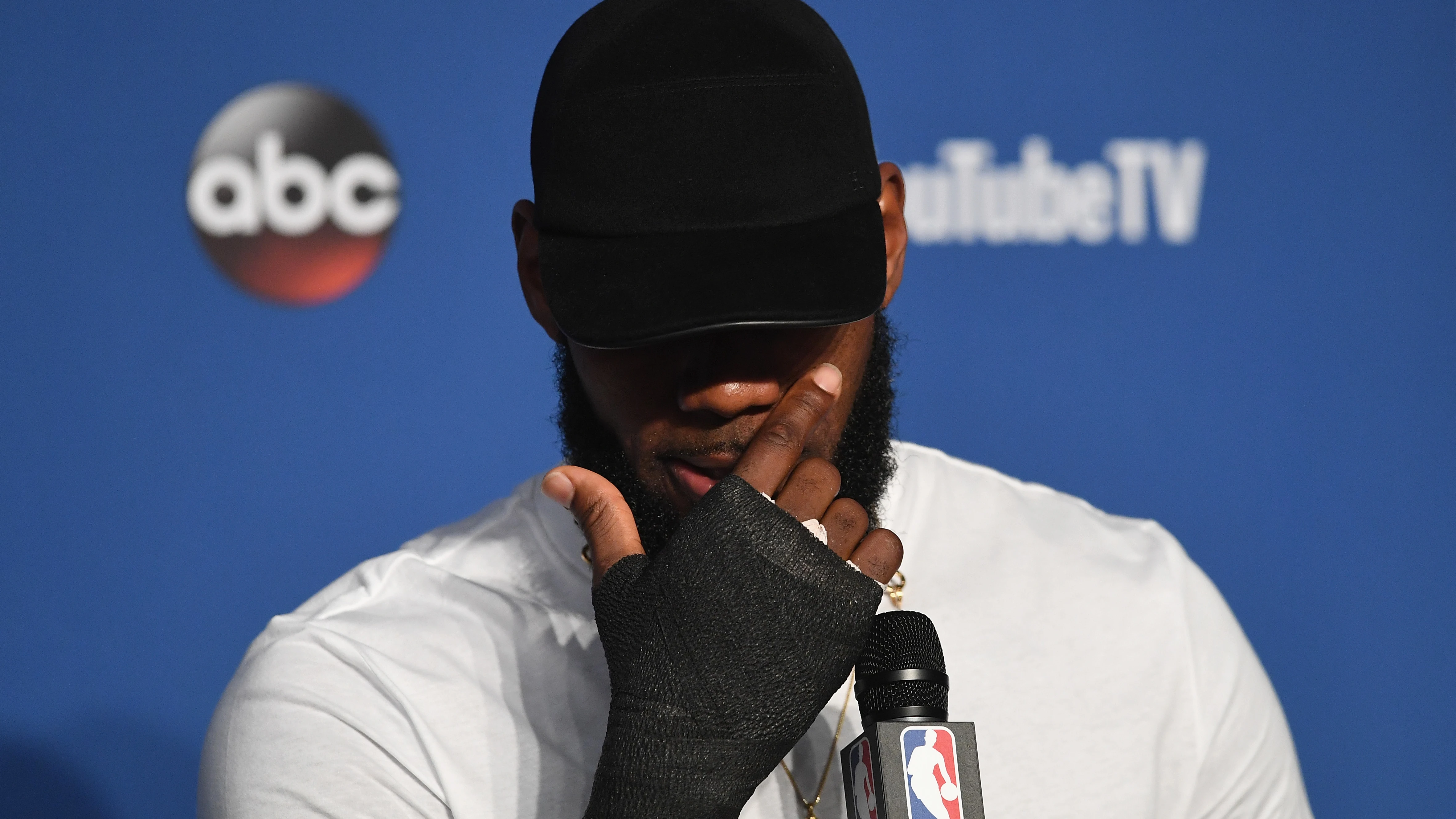 LeBron James, en rueda de prensa con la protección en la mano derecha