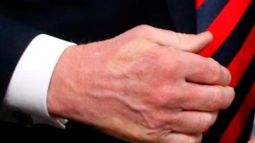 La mano de Trump marcada con los dedos de Macron