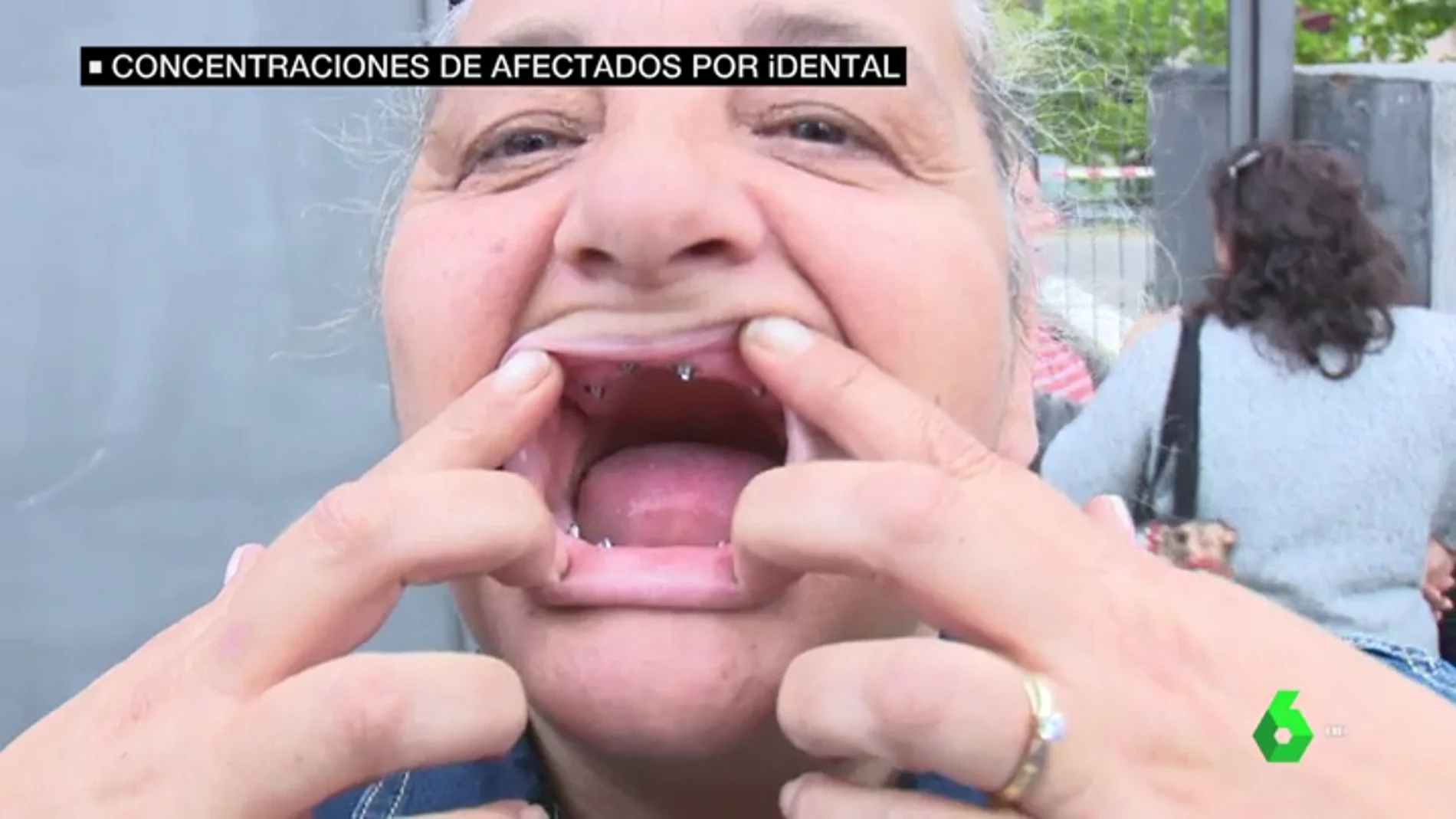 Una mujer con un tratamiento dental a medias