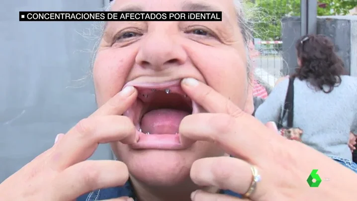 Una mujer con un tratamiento dental a medias