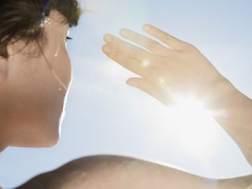 Lesiones por la luz solar Lesiones por la luz solar