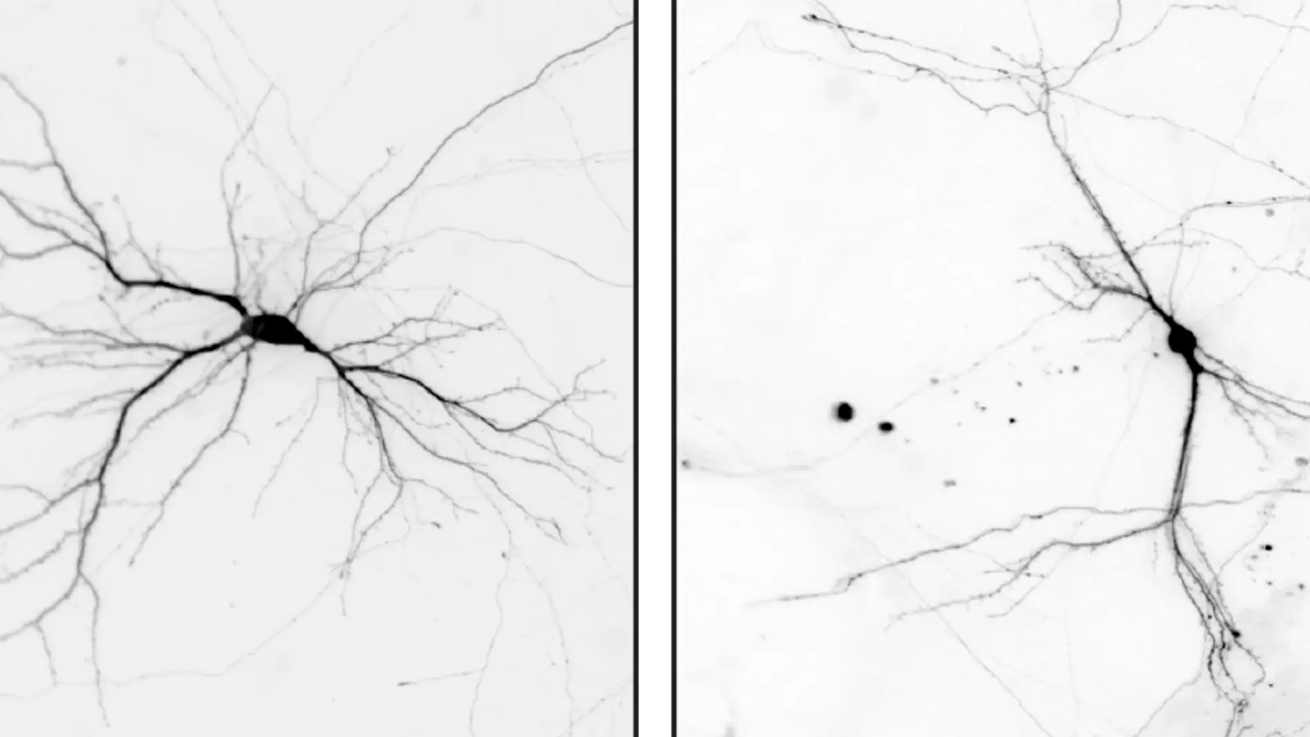 Identifican un nuevo regulador de la formacion de neuronas