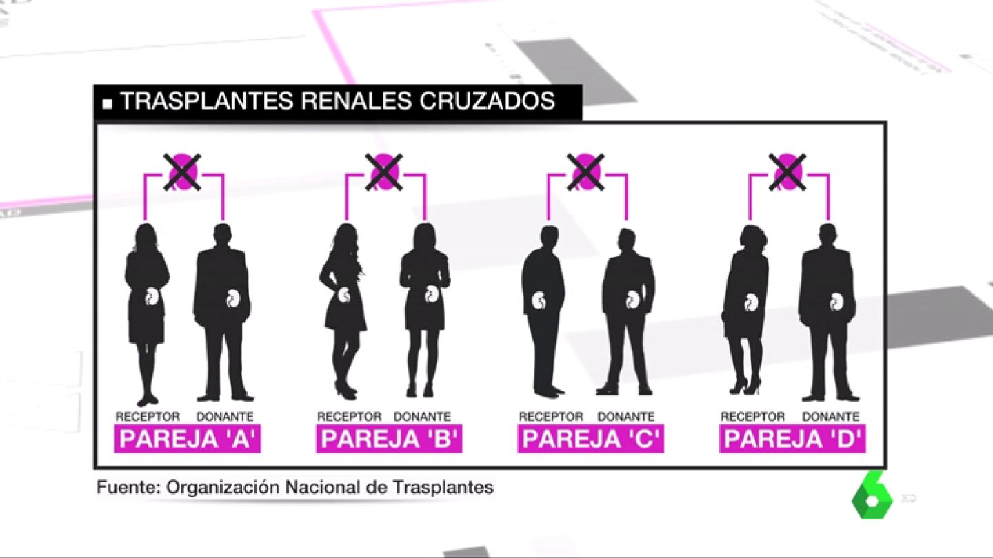 As&iacute; es el sistema estadounidense de donantes cruzados que Europa rechaza