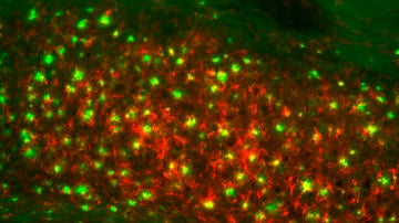 Sección de cerebro de un ratón transgénico para EA mostrando acumulaciones de placas amiloides (verde) y ferritina (rojo). Barra de escala: 100m. Fuente: ACS Chem. Neurosci., 2018, 9 (5), pp 912–924
