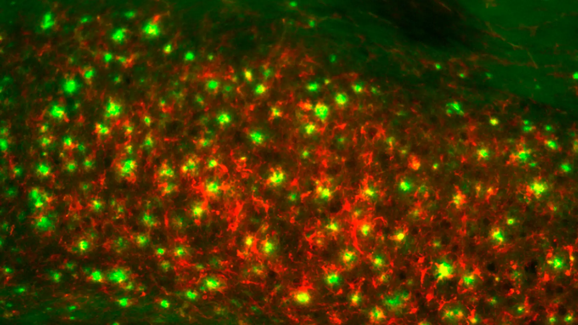 Sección de cerebro de un ratón transgénico para EA mostrando acumulaciones de placas amiloides (verde) y ferritina (rojo). Barra de escala: 100m. Fuente: ACS Chem. Neurosci., 2018, 9 (5), pp 912–924