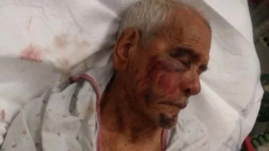 El anciano que fue agredido en Estados Unidos El anciano que fue agredido en Estados Unidos