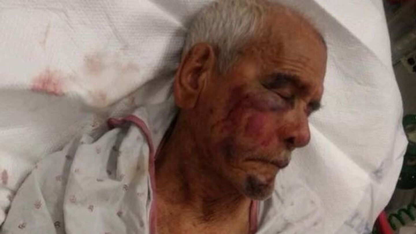 El anciano que fue agredido en Estados Unidos