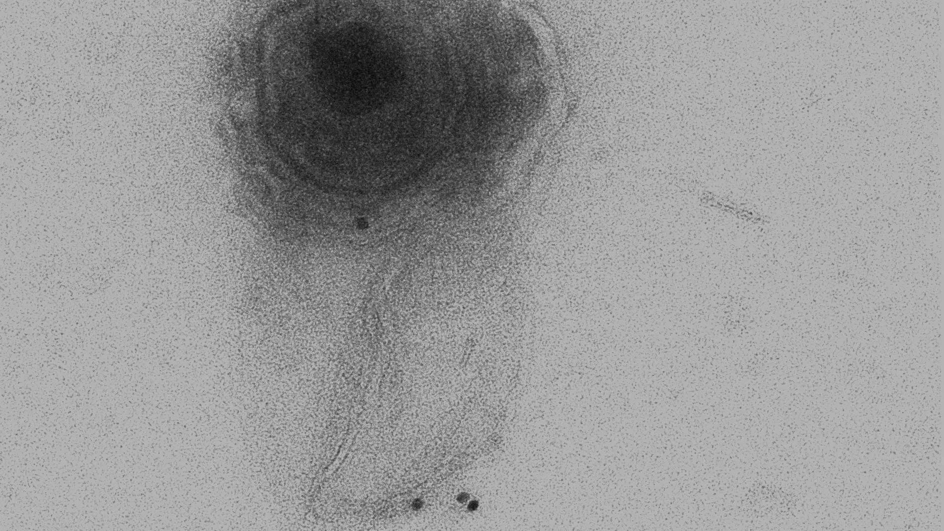 microvesícula conteniendo un virión