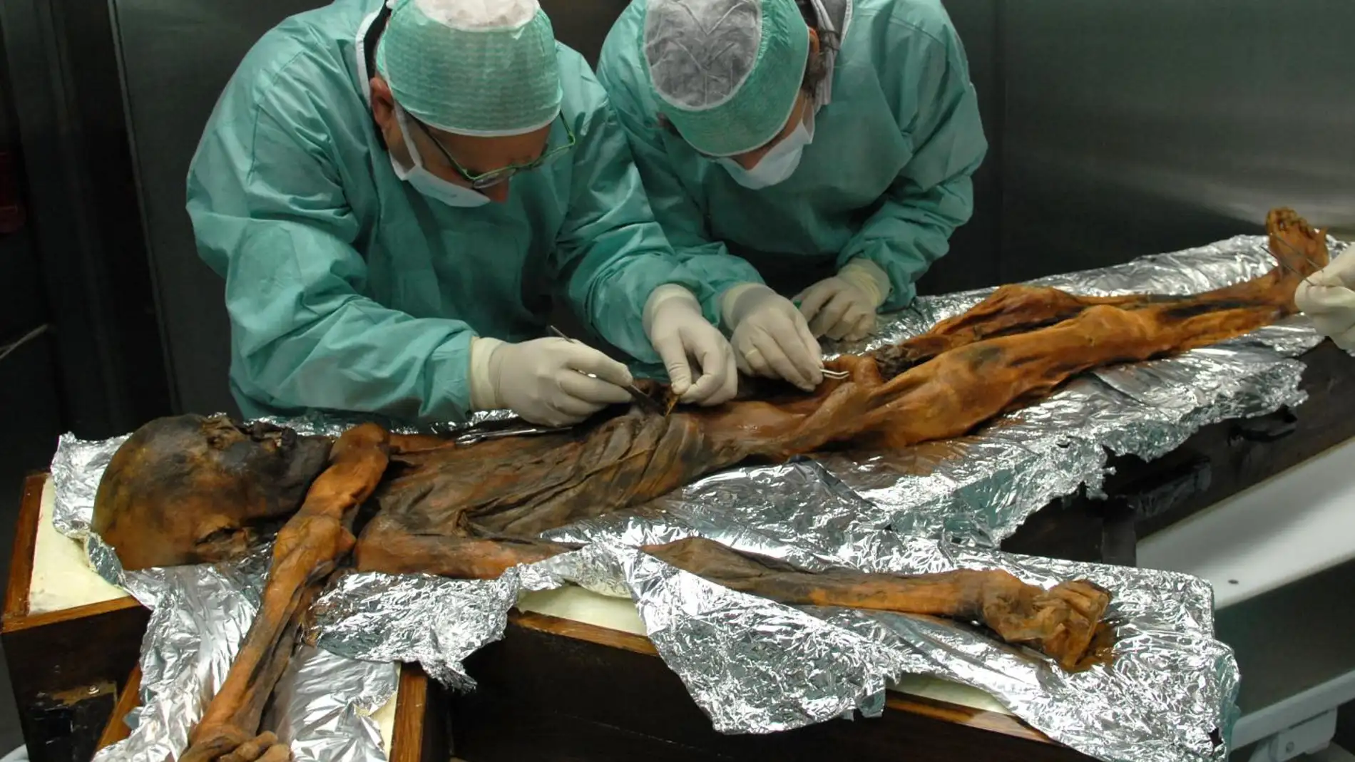 El ultimo banquete de Oetzi arroja luz sobre la alimentacion de hace 5.000 anos