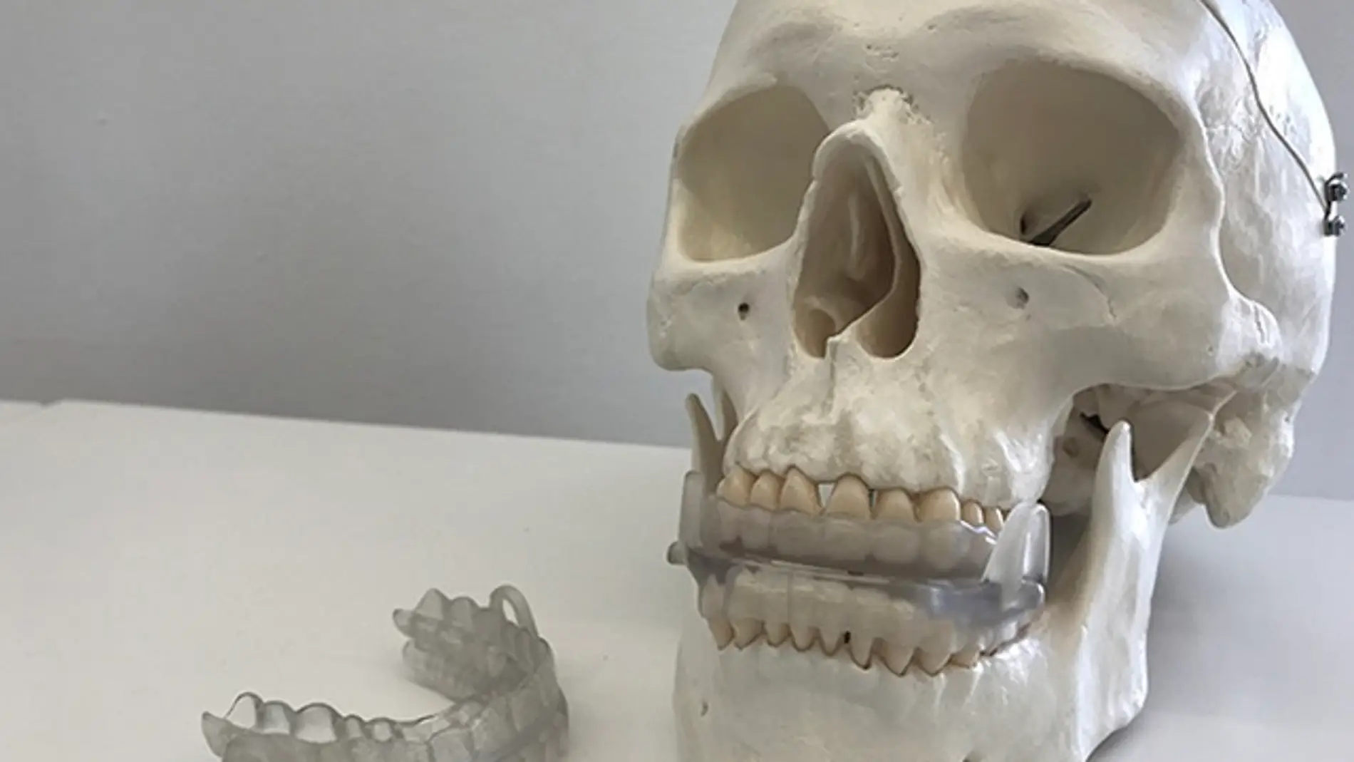 Impresion 3D personalizada para prevenir la apnea del sueno