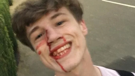 Joven agredido Joven agredido