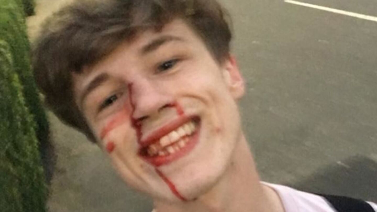 Joven agredido