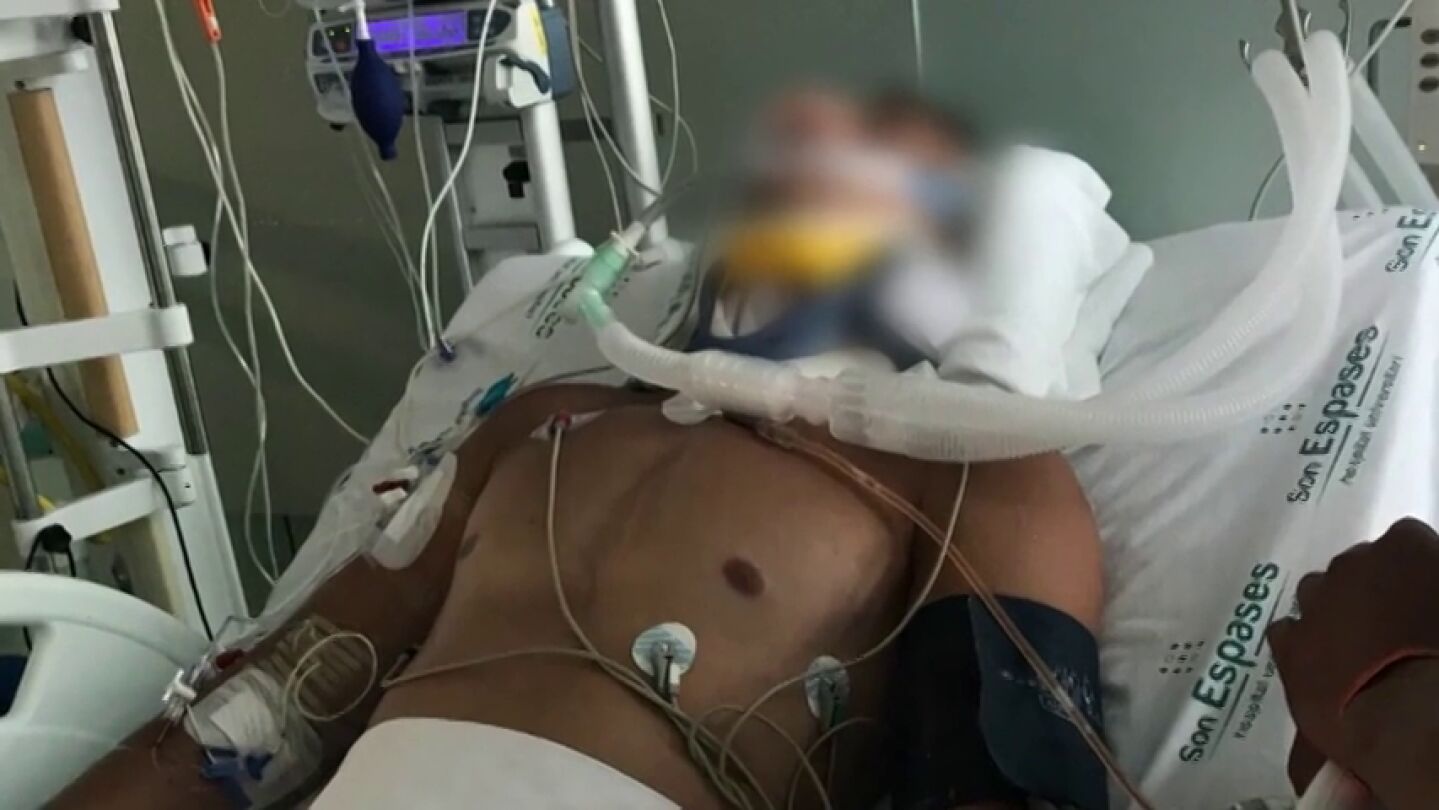 La pareja del turista brit&aacute;nico que se fractur&oacute; el cuello en una piscina de Magaluf pide dinero para su traslado