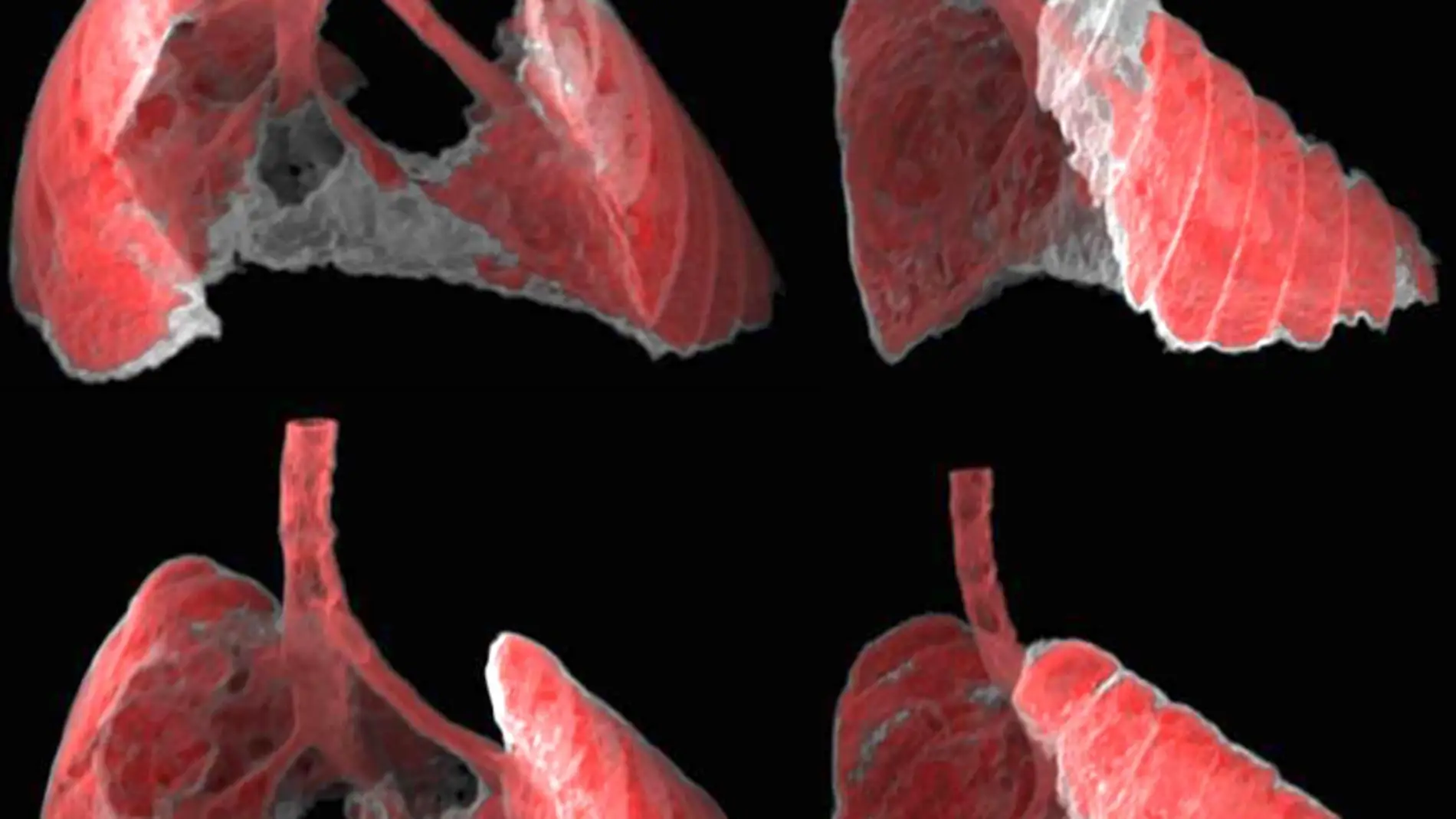 pulmones de un ratón con fibrosis