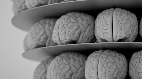 El cerebro puede hacernos sentir placer ante espectáculos desagradables 