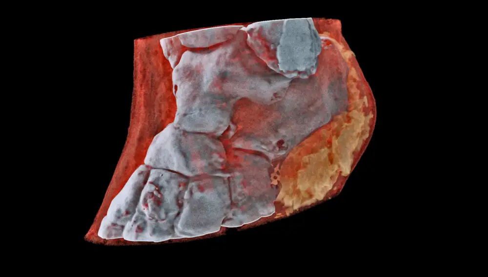 Radiografía tridimensional a color de un tobillo humano