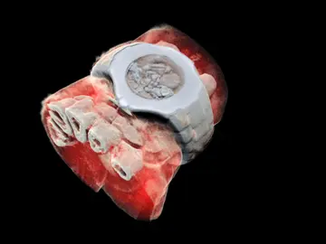 Radiografía a color de una muñeca en la que se aprecian los huesos, los tejidos blandos y hasta un reloj  Radiografía a color de una muñeca en la que se aprecian los huesos, los tejidos blandos y hasta un reloj