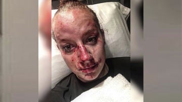 Policía herida tras una pelea con un joven 
