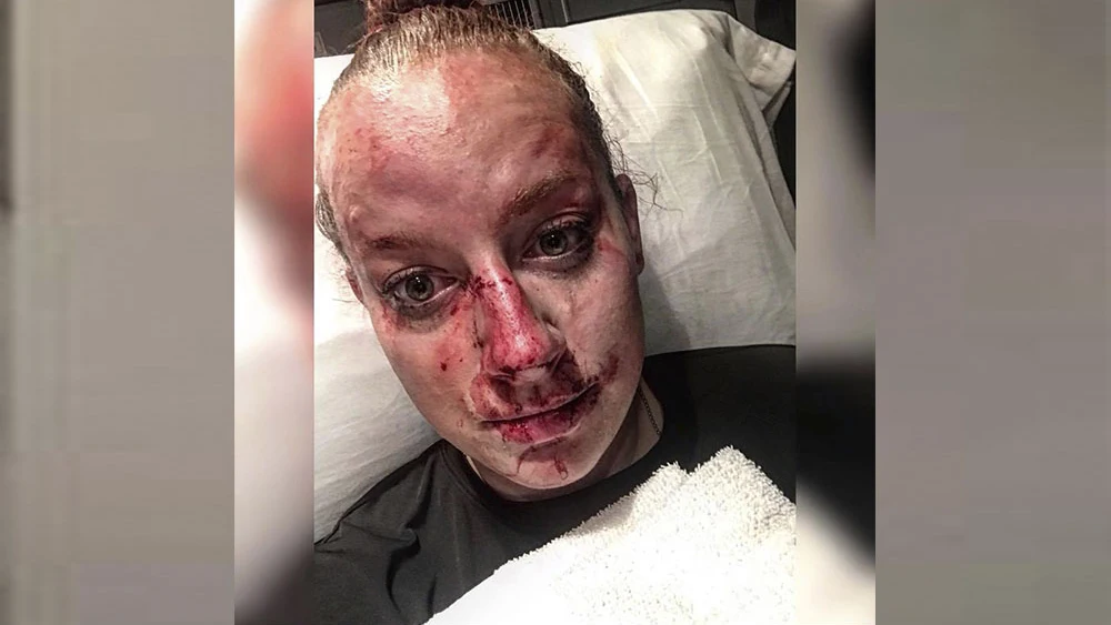 Policía herida tras una pelea con un joven Policía herida tras una pelea con un joven