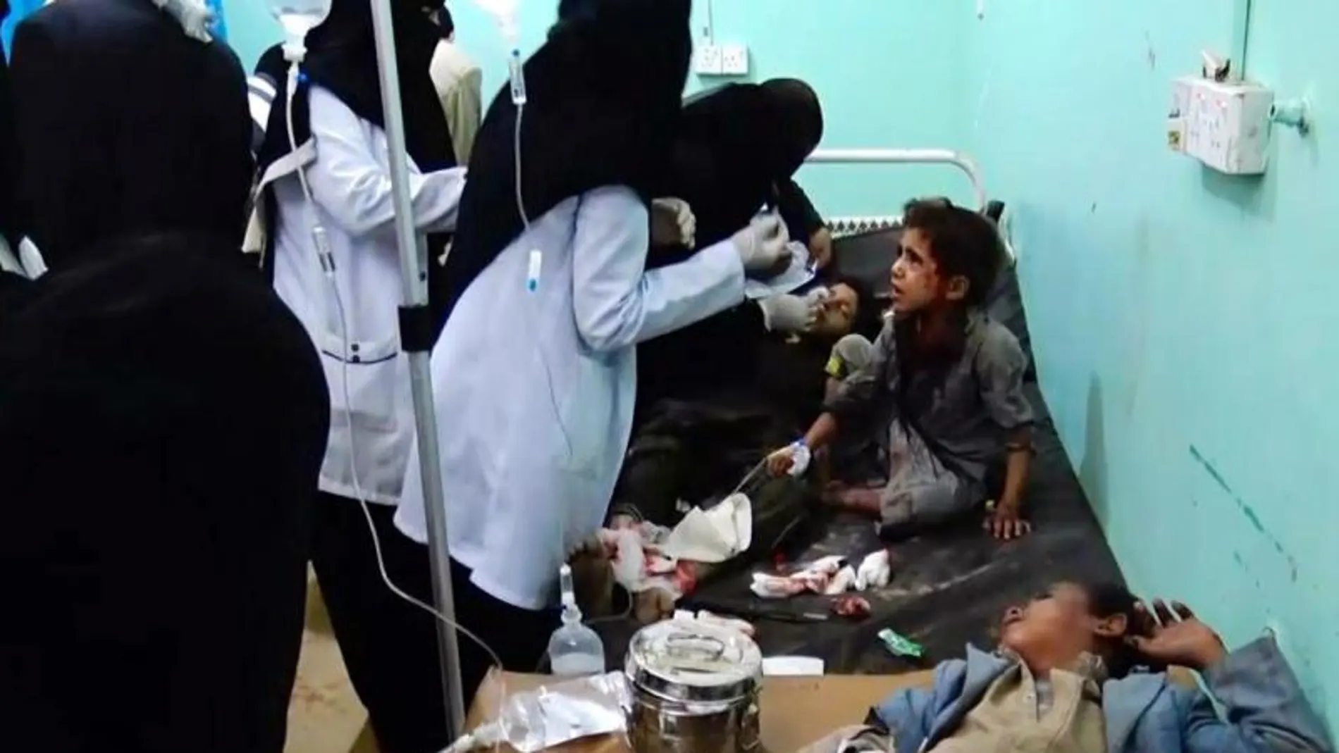 Varios niños heridos reciben atención médica en un hospital tras el bombardeo en Yemen