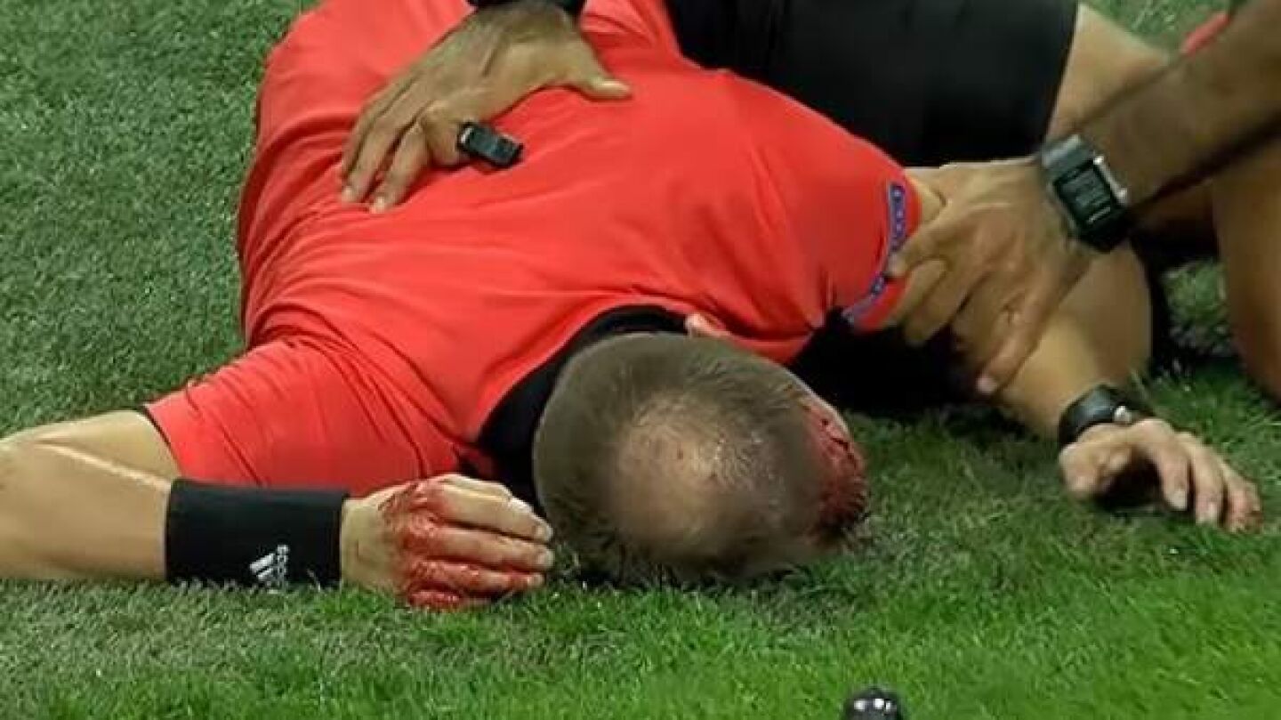 Terrible agresi&oacute;n en la Europa League