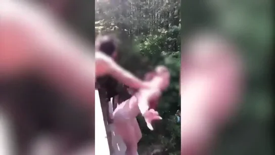 Cinco costillas rotas y el pulmón dañado: un empujón que pudo costarle la vida a esta joven de EEUU Cinco costillas rotas y el pulmón dañado: un empujón que pudo costarle la vida a esta joven de EEUU
