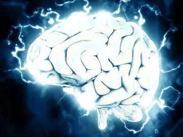 Cerebro Cerebro