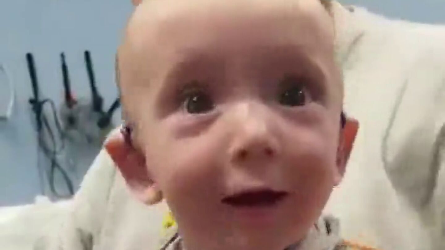 La tierna y emotiva reacci&oacute;n de un beb&eacute; con sordera al escuchar por primera vez la voz de su madre