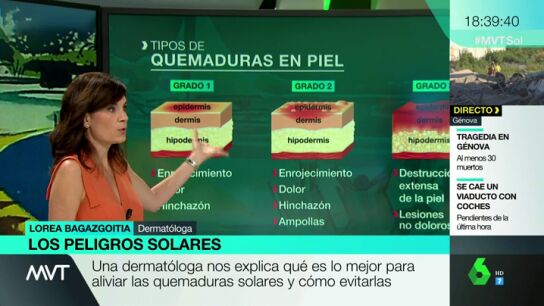 Las quemaduras solares nos dejan huella de por vida: una dermat&oacute;loga explica c&oacute;mo evitarlas y c&oacute;mo tratar la piel afectada