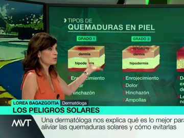 Las quemaduras solares nos dejan huella de por vida: una dermatóloga explica cómo evitarlas y cómo tratar la piel afectada Las quemaduras solares nos dejan huella de por vida: una dermatóloga explica cómo evitarlas y cómo tratar la piel afectada