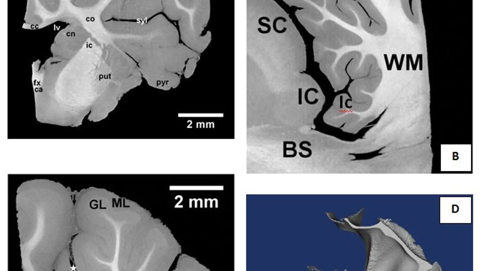 Nueva tecnica para visualizar el tejido cerebral