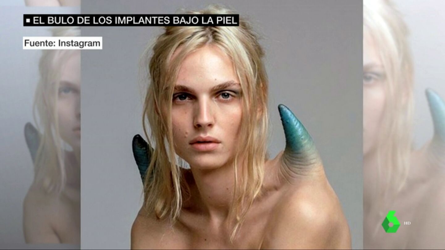 Con incisiones e implantes que aumenten el espacio bajo la piel: as&iacute; podr&iacute;an ser los tatuajes del futuro