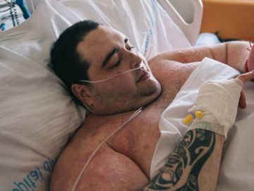 Imagen de Teófilo Rodríguez, el joven con obesidad mórbida que pesa 385 kilos Imagen de Teófilo Rodríguez, el joven con obesidad mórbida que pesa 385 kilos