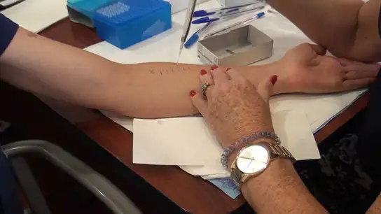 Prueba de alergias Prueba de alergias