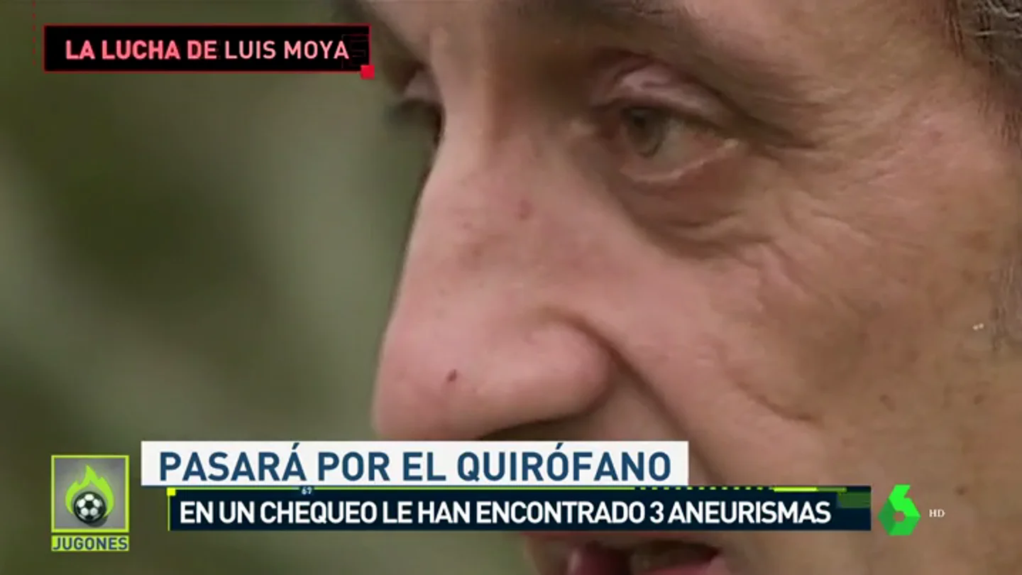 Luis Moya tendrá que operarse de 3 aneurismas cerebrales Luis Moya tendrá que operarse de 3 aneurismas cerebrales