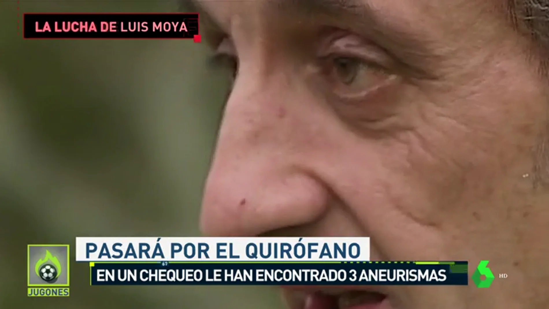 Luis Moya tendrá que operarse de 3 aneurismas cerebrales