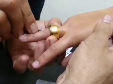 Los Bomberos extraen un anillo encajado en el dedo de un niño