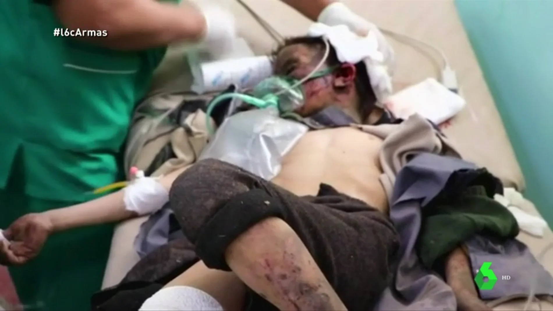 Imagen de un niño hospitalizado en Yemen