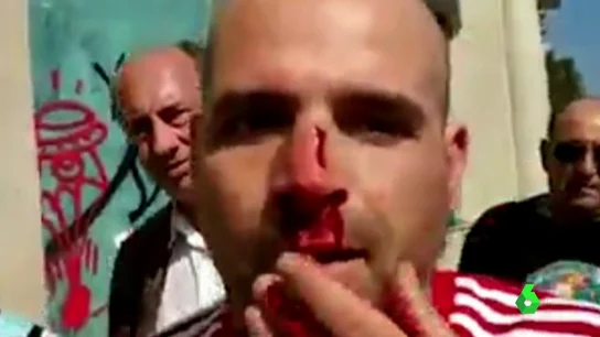 El testimonio del policía nacional agredido en Barcelona: "Me pegaron entre cuatro o cinco. Veía que me mataban allí" El testimonio del policía nacional agredido en Barcelona: "Me pegaron entre cuatro o cinco. Veía que me mataban allí"
