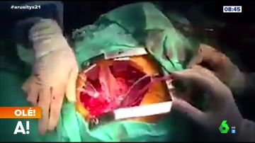 Las espectaculares imágenes de una operación a corazón abierto durante un terremoto 