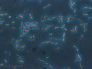 El Lactobacillus acidophilus es una de las muchas bacterias beneficiosas para nuestro cuerpo El Lactobacillus acidophilus es una de las muchas bacterias beneficiosas para nuestro cuerpo