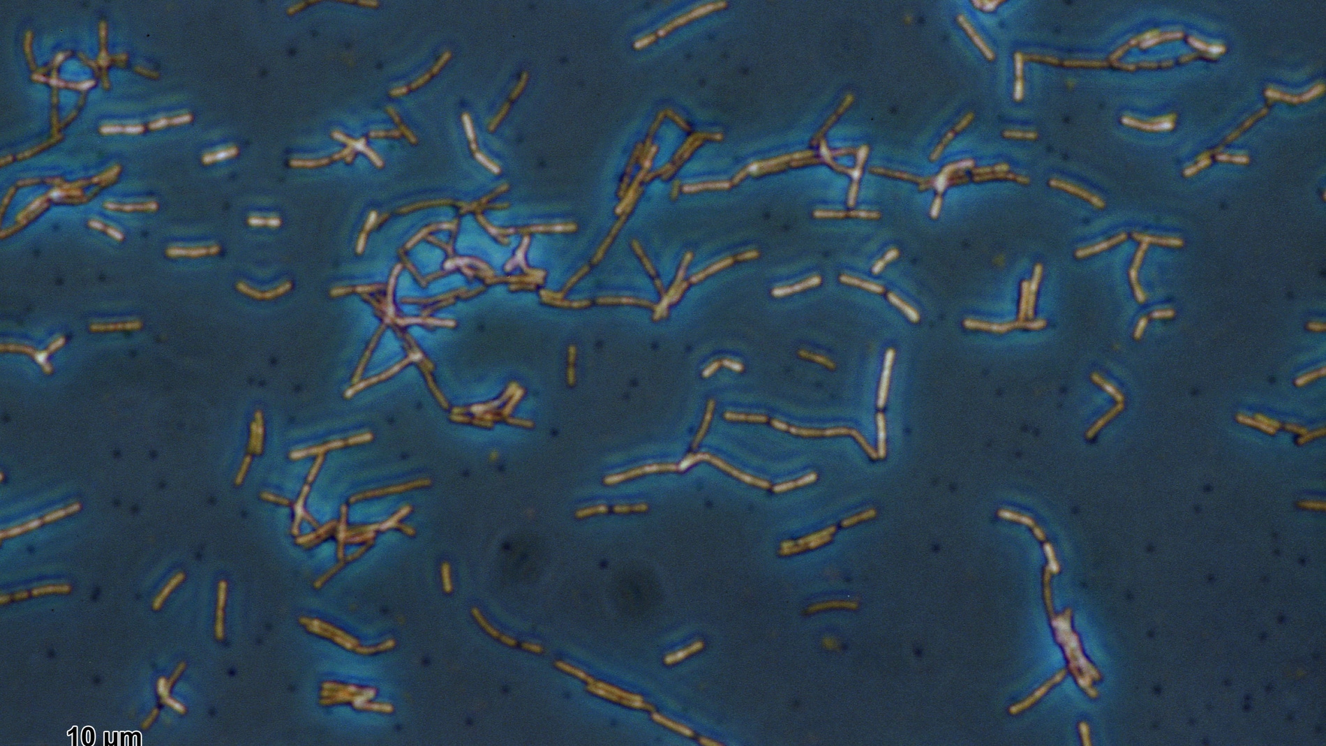 El Lactobacillus acidophilus es una de las muchas bacterias beneficiosas para nuestro cuerpo