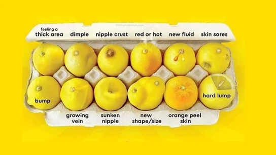 'Conoce tus limones': la guía para identificar las 12 señales visibles del cáncer de mama 'Conoce tus limones': la guía para identificar las 12 señales visibles del cáncer de mama