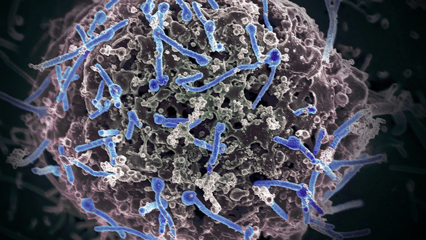 Imagen del virus del Ébola aislado de una muestra de sangre Imagen del virus del Ébola aislado de una muestra de sangre