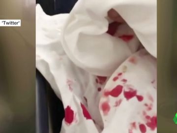 El impactante testimonio de los pasajeros del accidentado vuelo entre Argentina y Miami: "Había sangre por todos lados" El impactante testimonio de los pasajeros del accidentado vuelo entre Argentina y Miami: "Había sangre por todos lados"