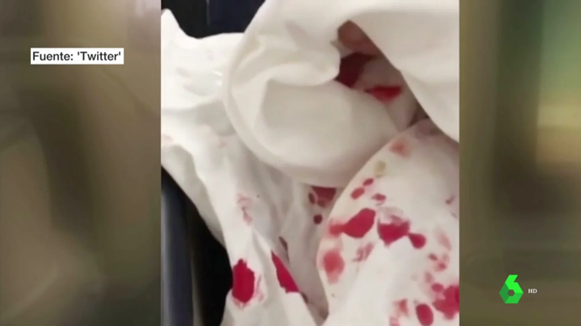 El impactante testimonio de los pasajeros del accidentado vuelo entre Argentina y Miami: "Había sangre por todos lados"