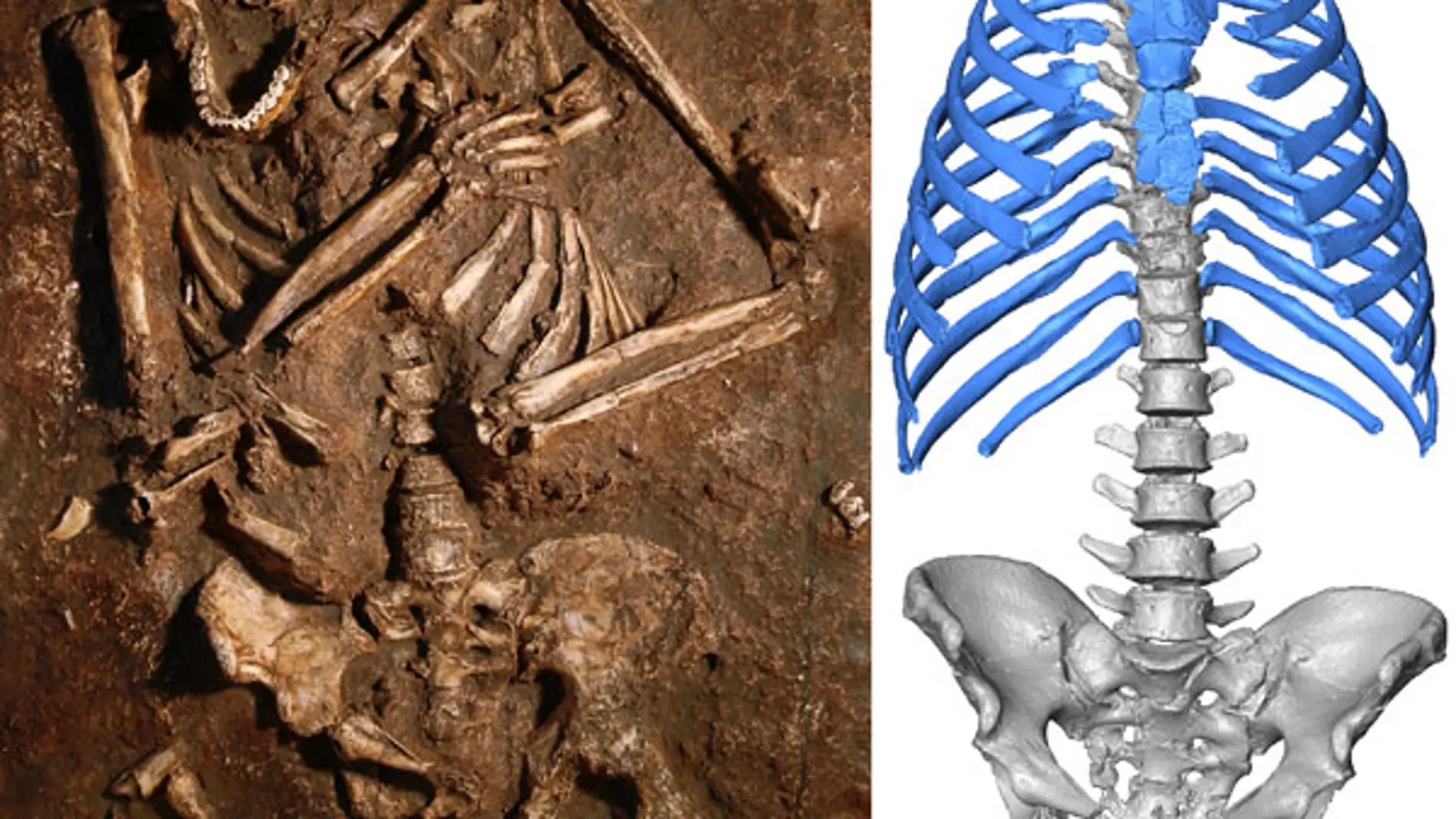 Reconstruyen por primera vez en 3D el torax de un neandertal