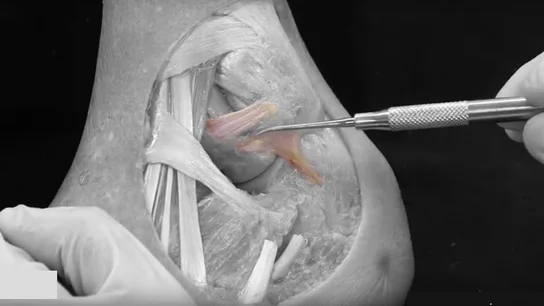 Ligamento descubierto por la Universidad de Barcelona Ligamento descubierto por la Universidad de Barcelona