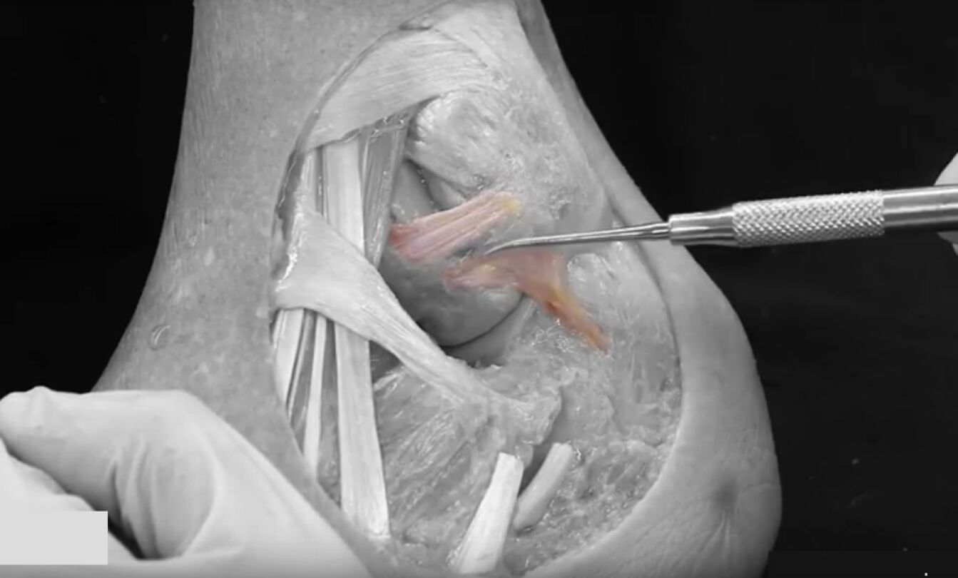Ligamento descubierto por la Universidad de Barcelona