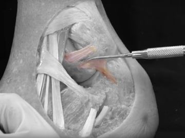 Ligamento descubierto por la Universidad de Barcelona Ligamento descubierto por la Universidad de Barcelona